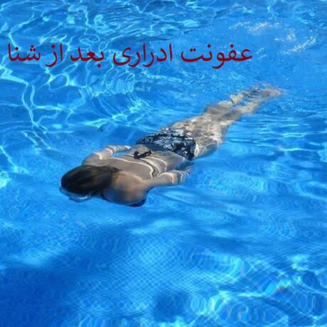 عفونت ادراری بعد از شنا | آنچه شناگران باید بدانند