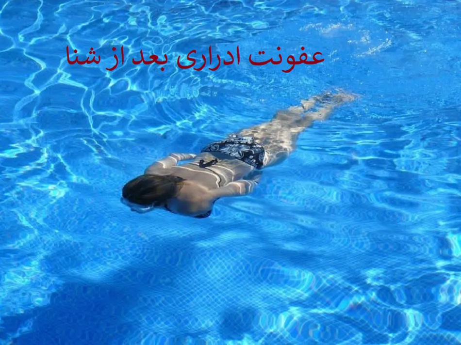 عفونت ادراری بعد از شنا | آنچه شناگران باید بدانند